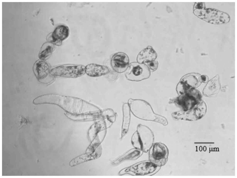 Induction and in-vitro culture method of plant stem cells derived from apical meristem of catharanthus roseus roots