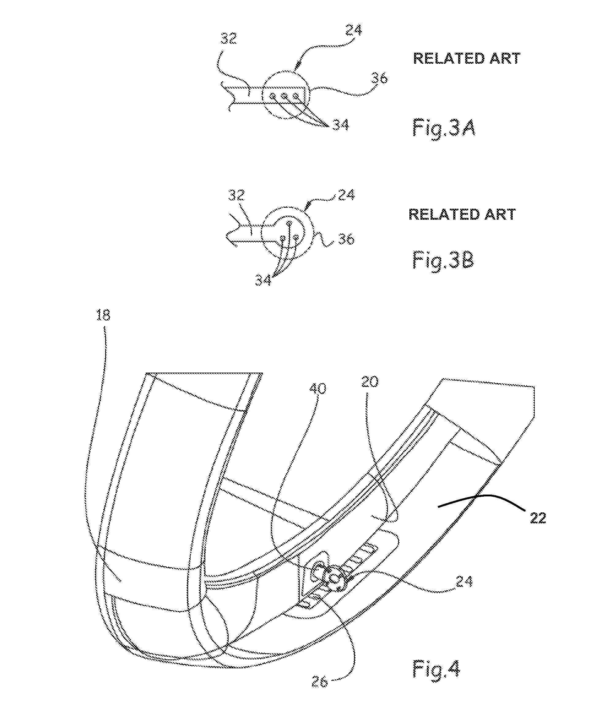 Aircraft nacelle air intake incorporating optimized ice-treatment hot air injection means