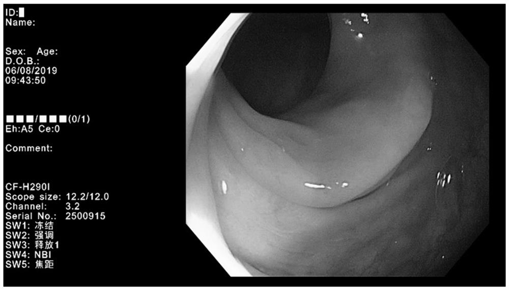 Medical image intelligent classification application method and device, equipment and storage medium