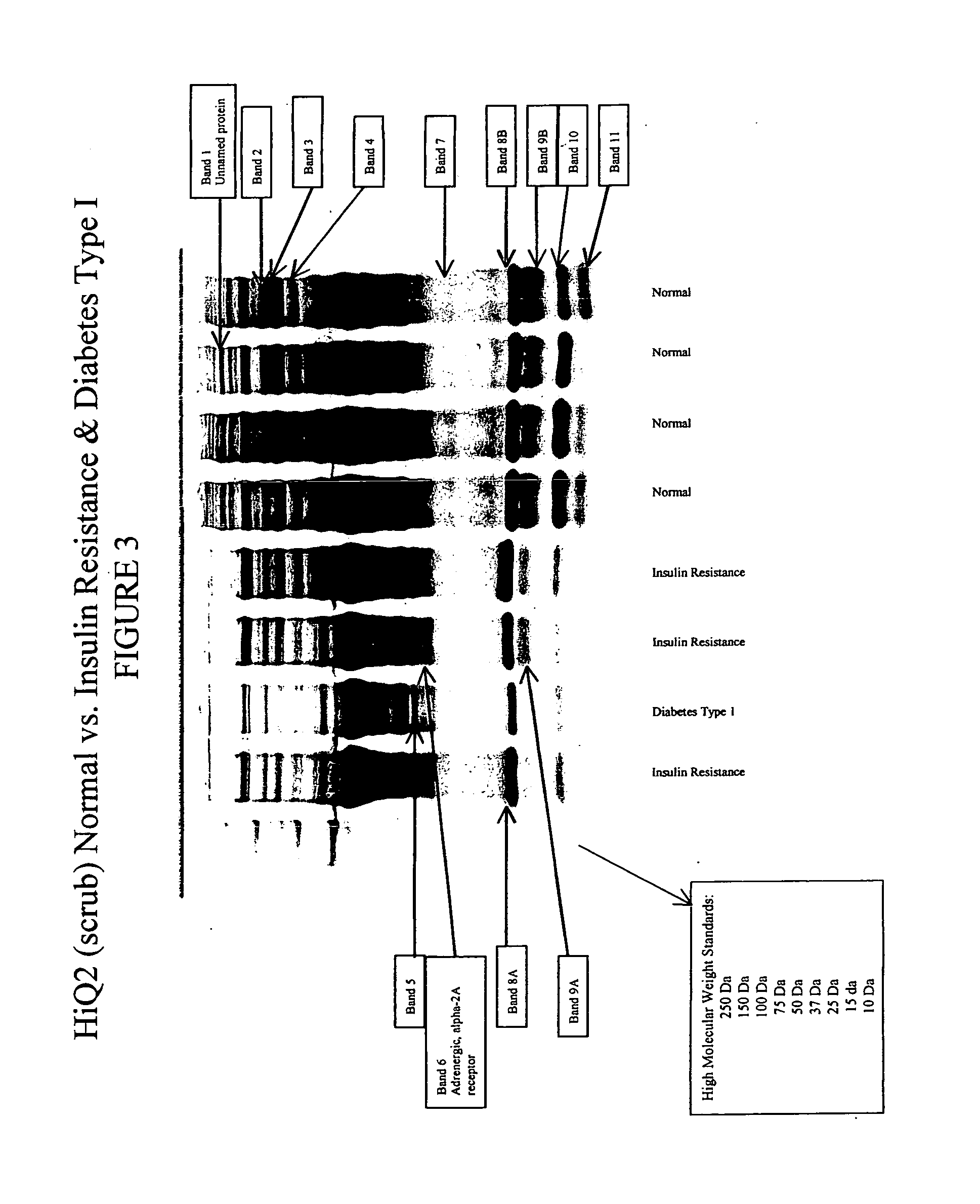 Protein biopolymer markers indicative of insulin resistance