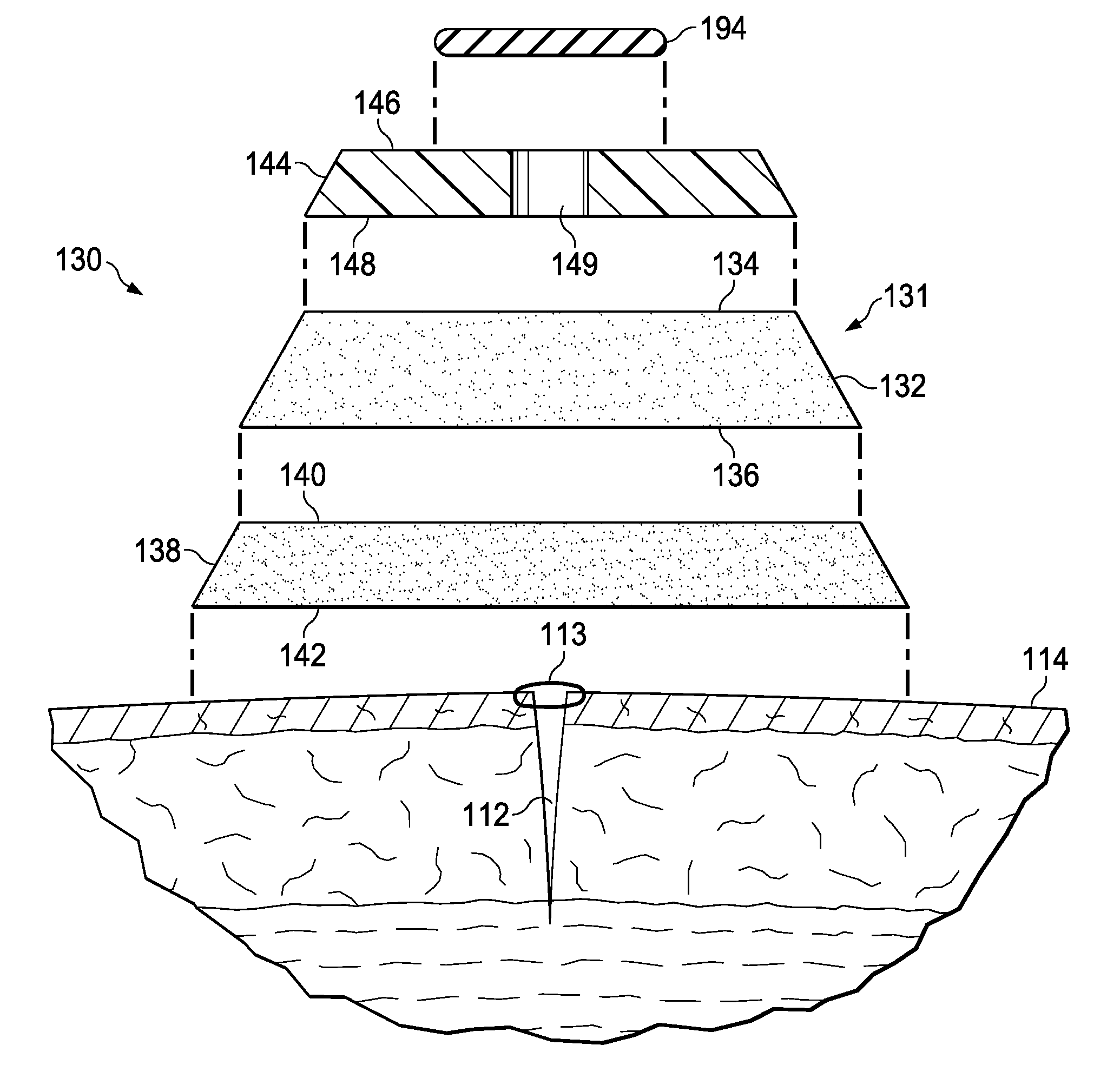 Super-absorbent, reduced-pressure wound dressings and systems