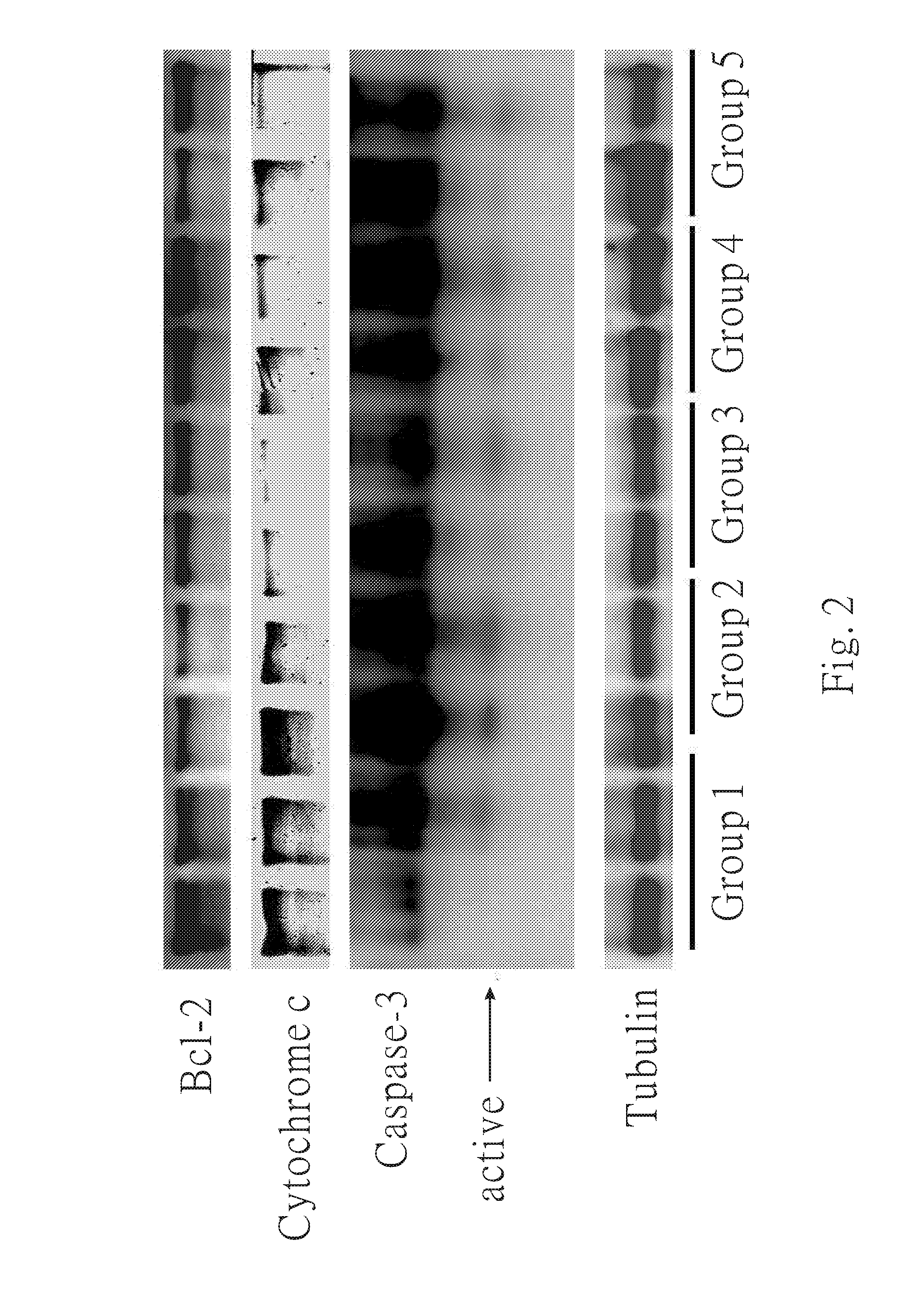 Method for preventing or treating heart diseases by using a composition containing an isolated peptide