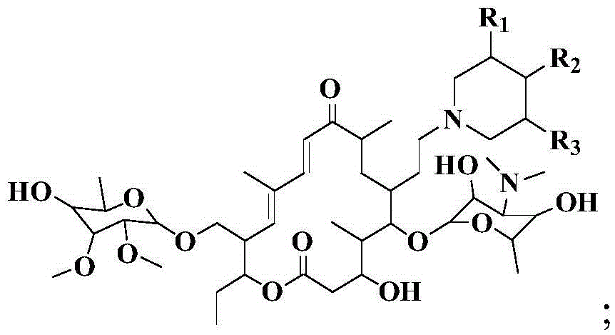 A kind of preparation method of tylosin macrolide and derivative thereof