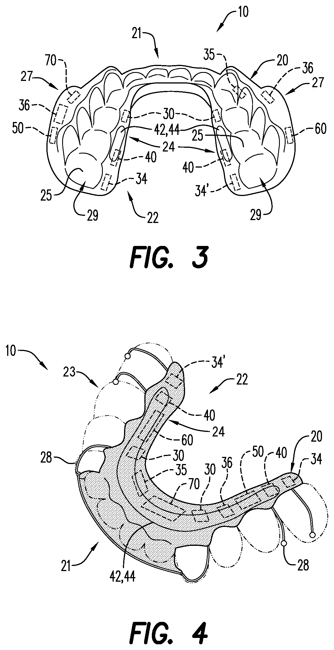 Intra-oral electroencephalography device and method