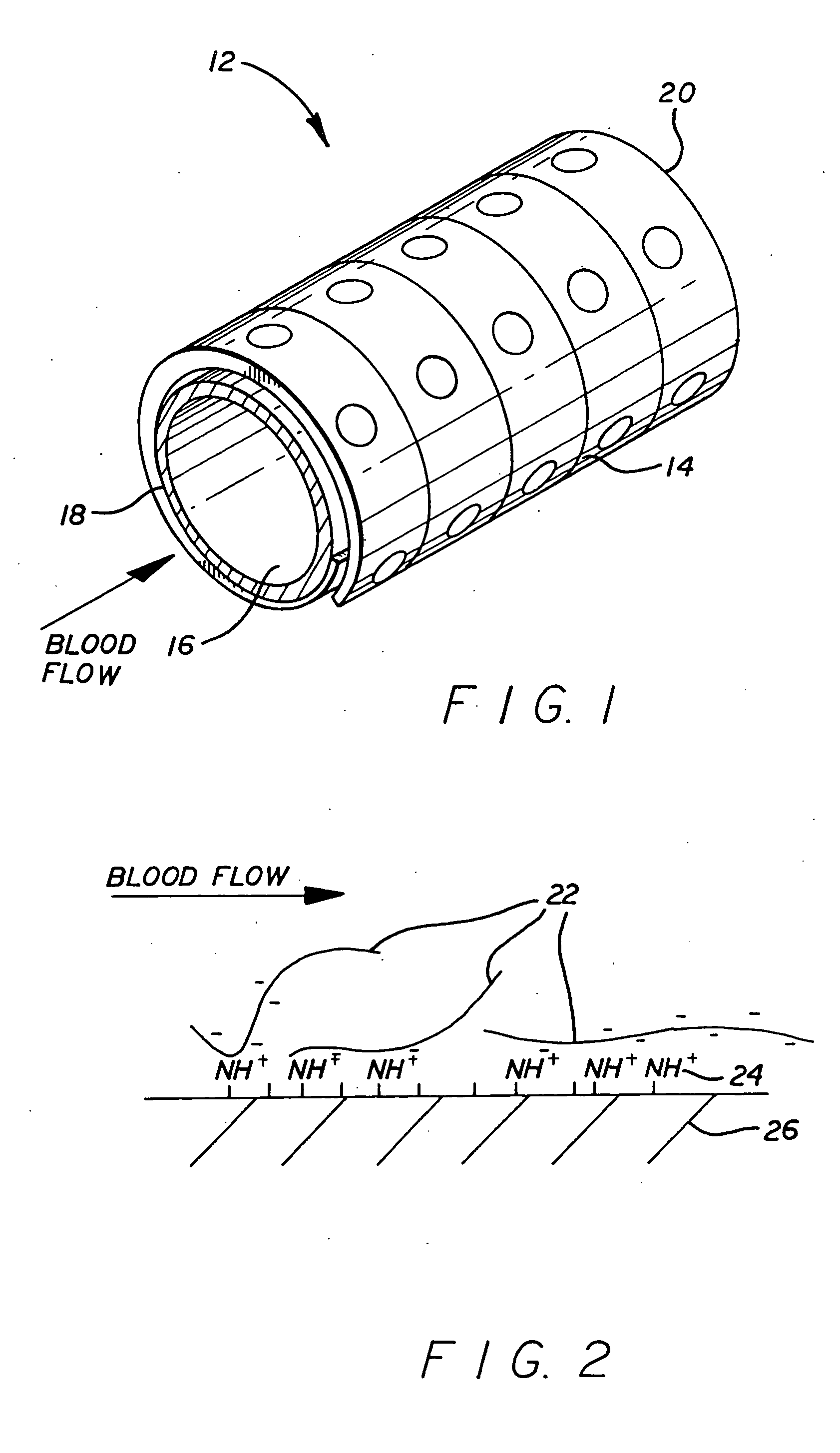 Coated endovascular stent