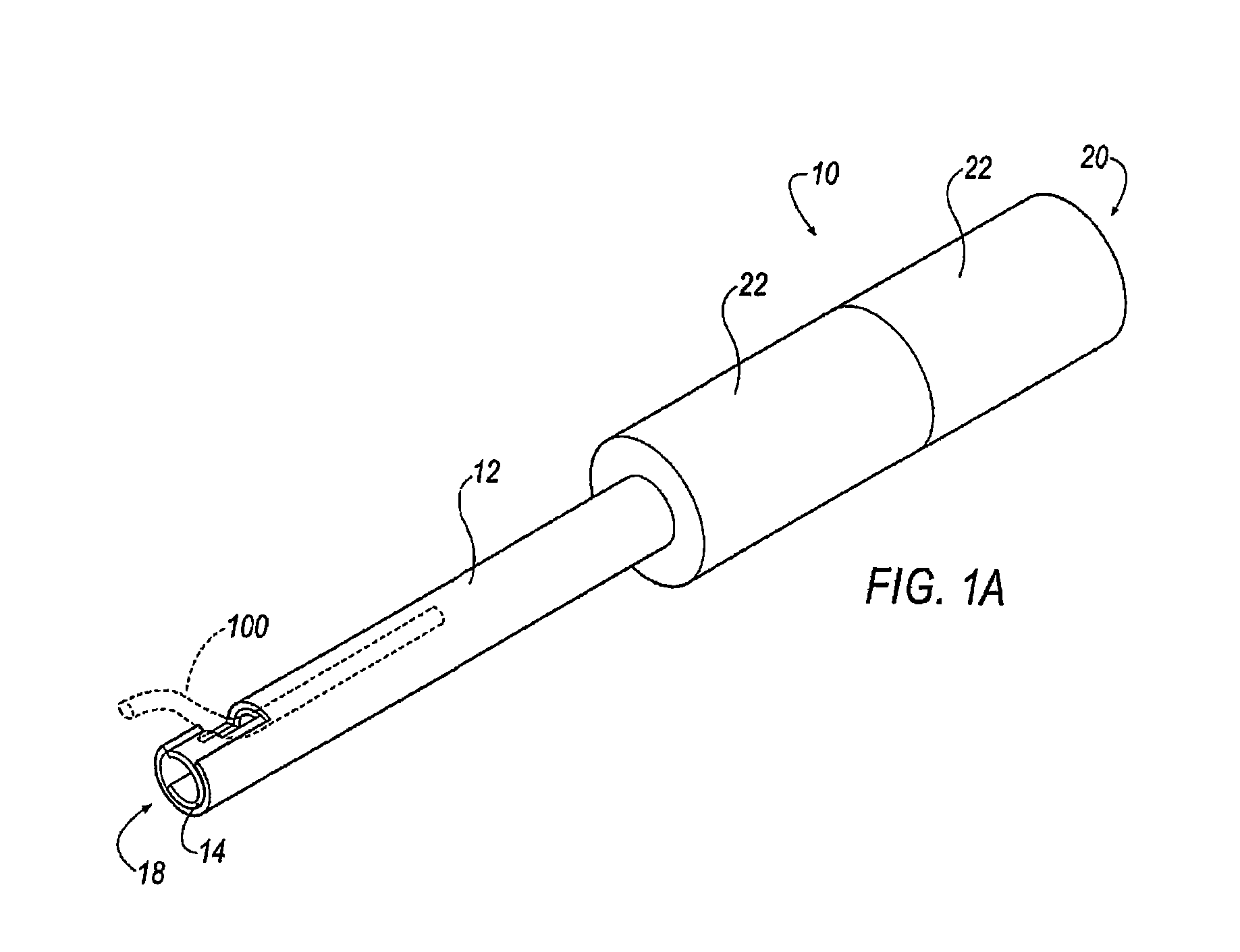 Endocardial lead removing apparatus