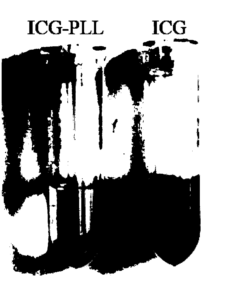 Preparation method and application of indocyanine green polymer nano particles