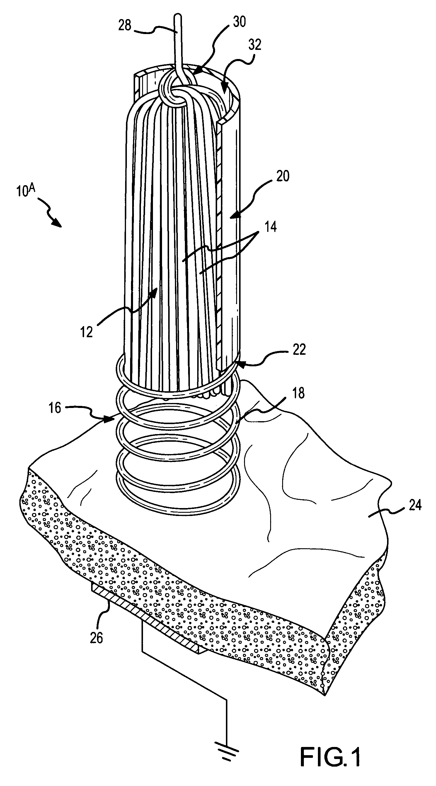 Spring-tip, flexible electrode catheter for tissue ablation