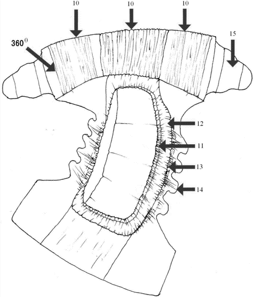 Double-negative-oxygen-ion and double-ring-leakage life sanitation product