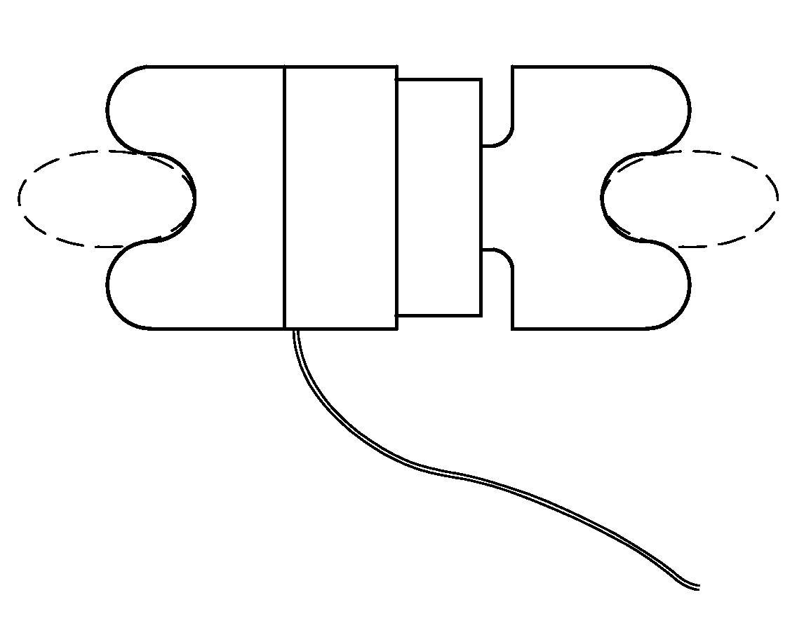 Expandable Spinous Process Distractor