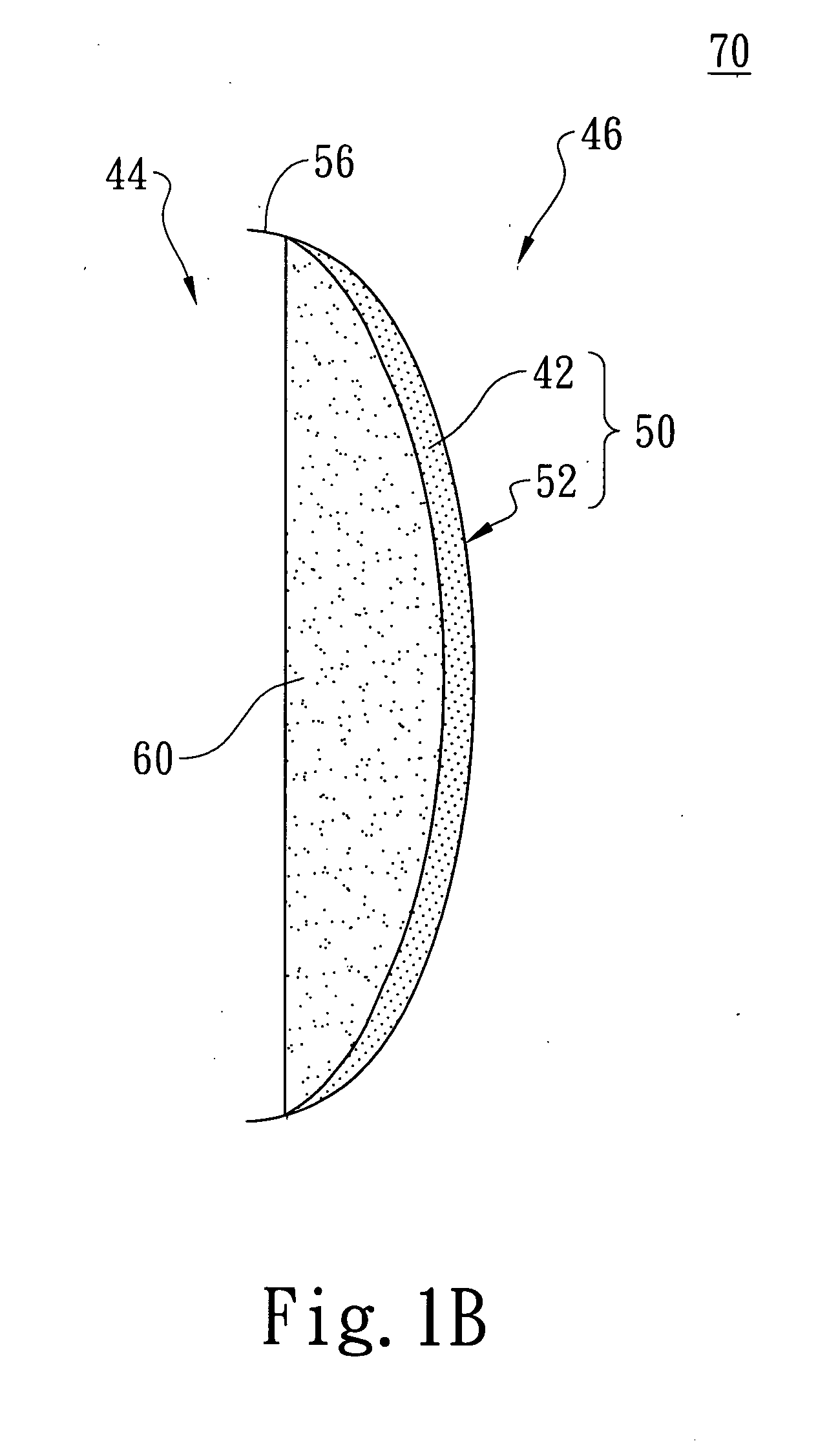 Posterior-form enhancement device