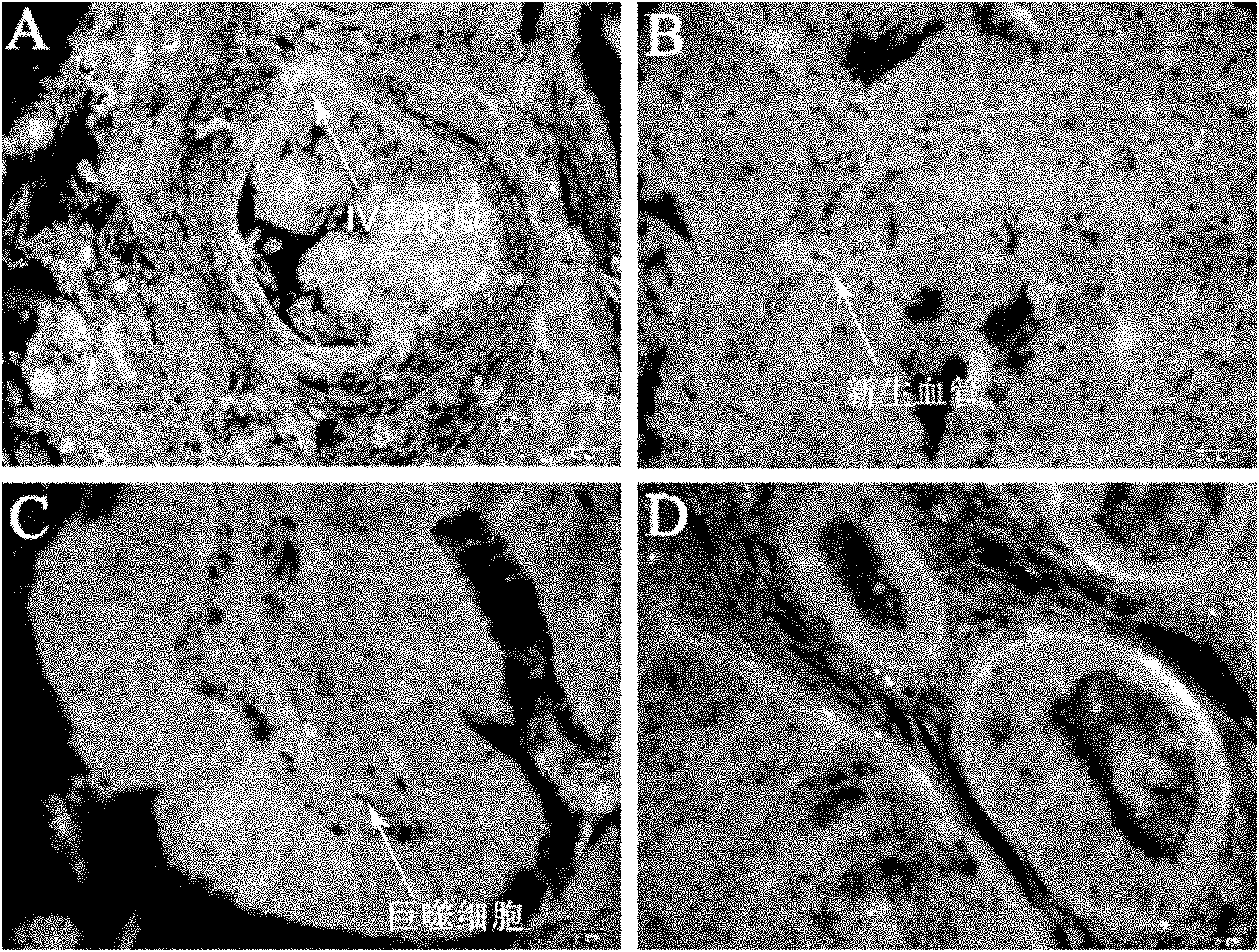 Method for simultaneously labelling collagen type IV, macrophage and neovascularisation of tumors