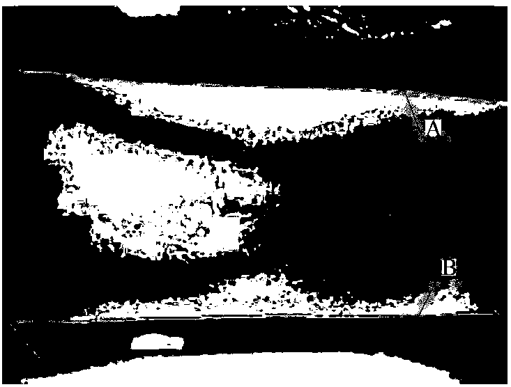 Method and device for discriminating finger vein pressing images and method for recognizing finger vein