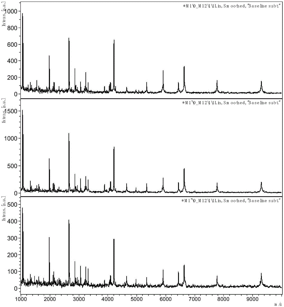 Autistic serum polypeptide marker PF4-A and application thereof