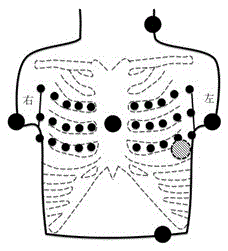 An electrocardiographic ultrasound signal fusion tomographic imaging system and method