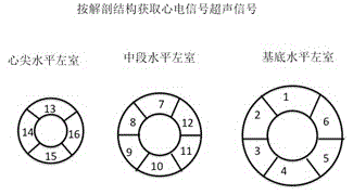 An electrocardiographic ultrasound signal fusion tomographic imaging system and method