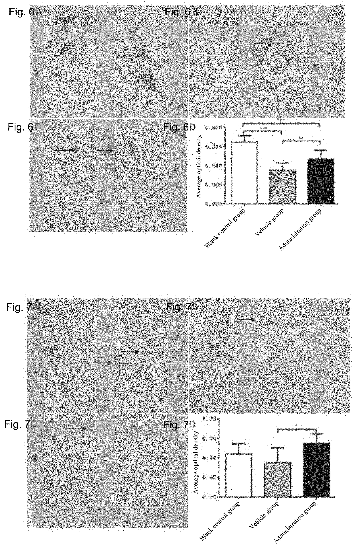 Method and medicine for treating amyotrophic lateral sclerosis