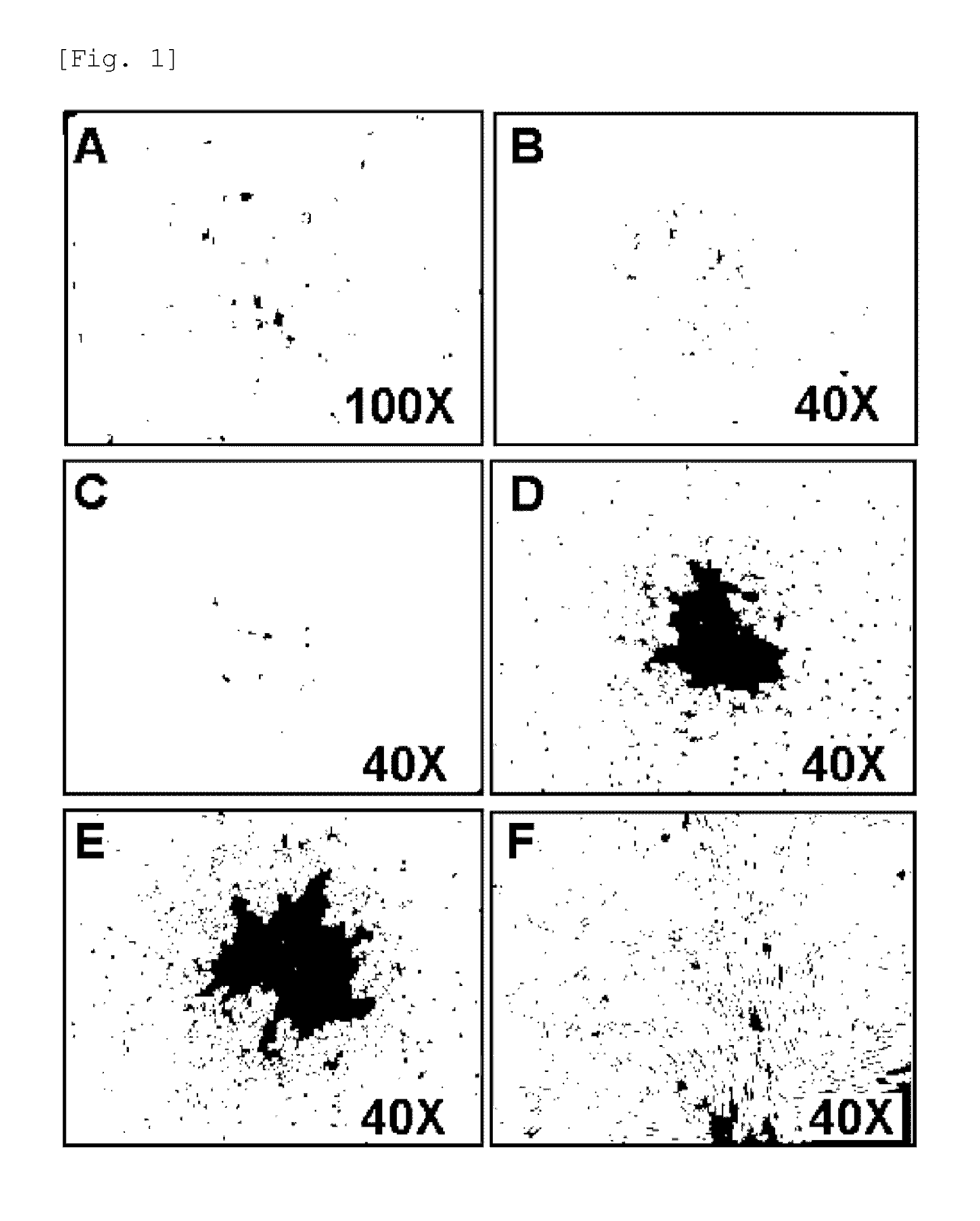 Isolating method for umbilical cord blood-derived pluripotent stem cells expressing znf281