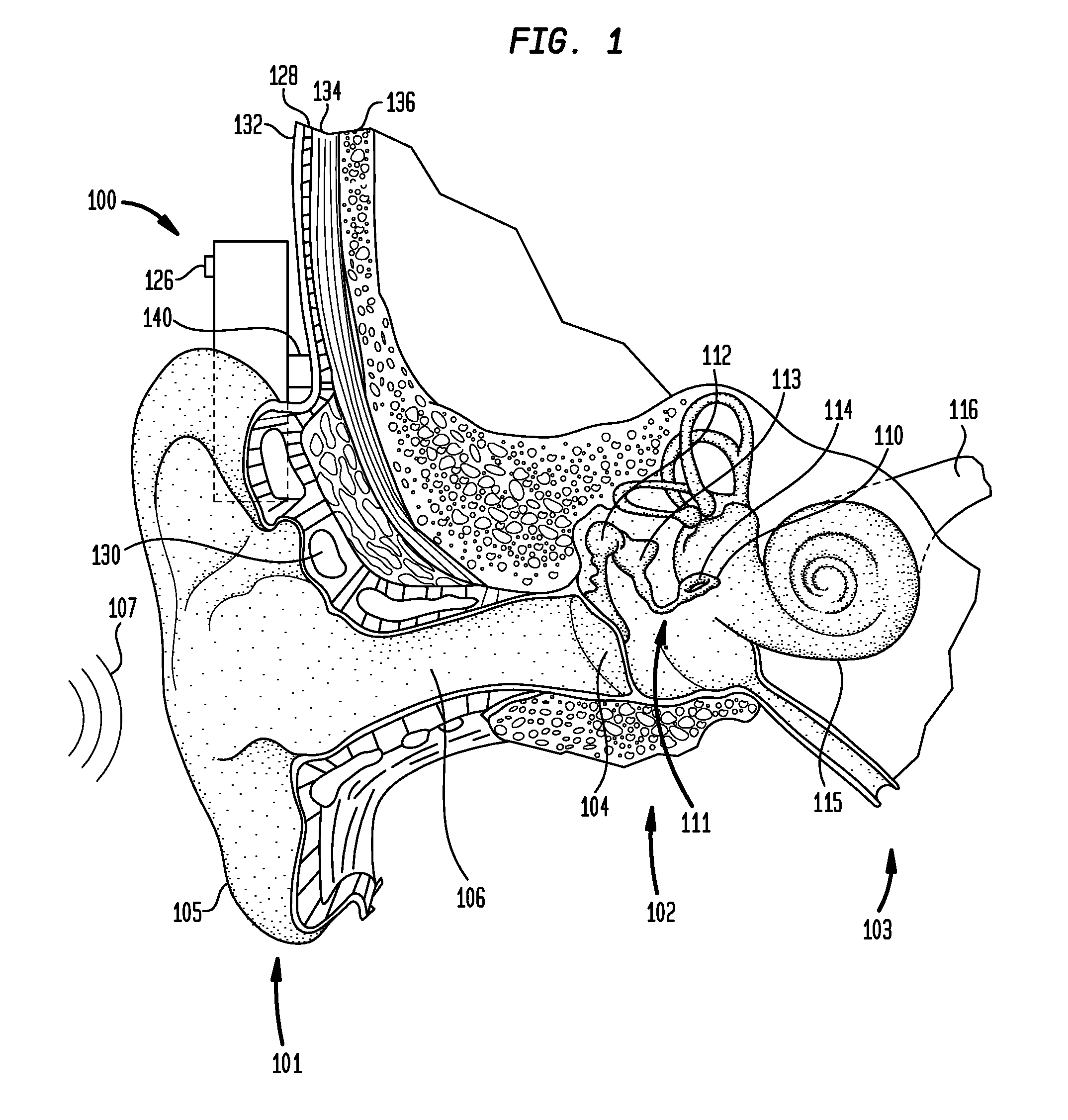 Bone conduction device having an integrated housing and vibrator mass