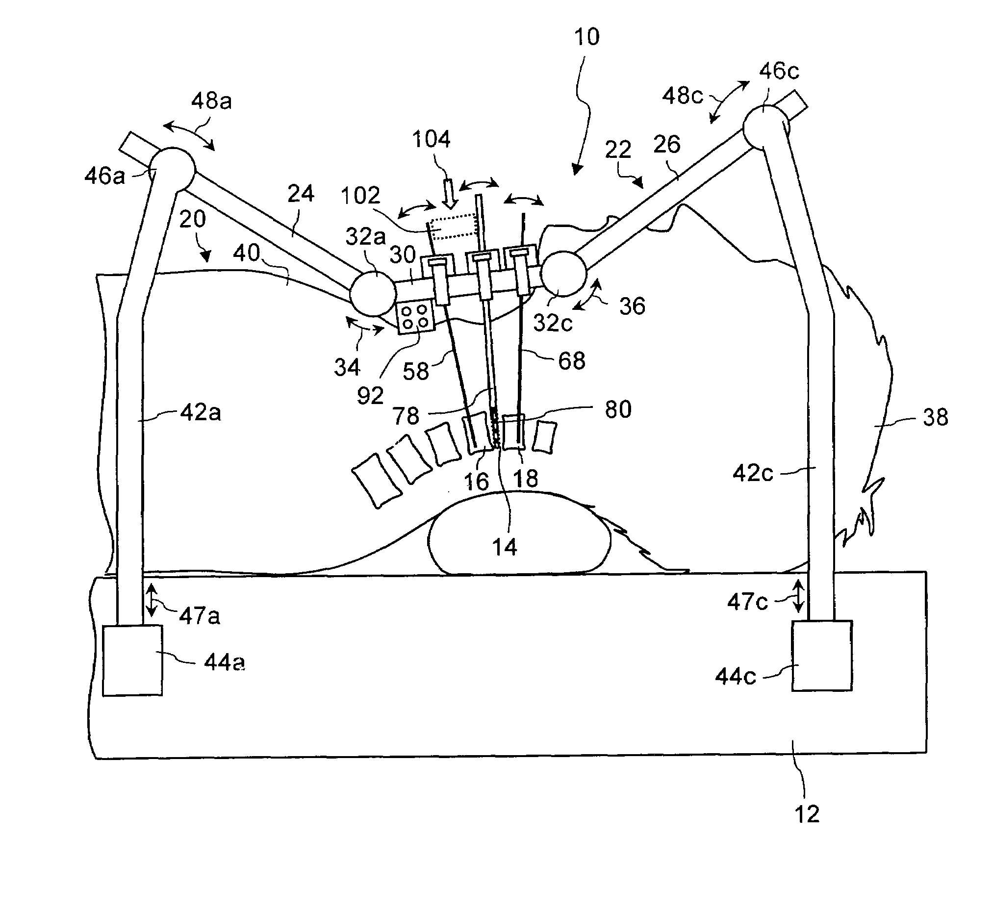 Preparation Device For Preparing an Intervertebral Disc Compartment