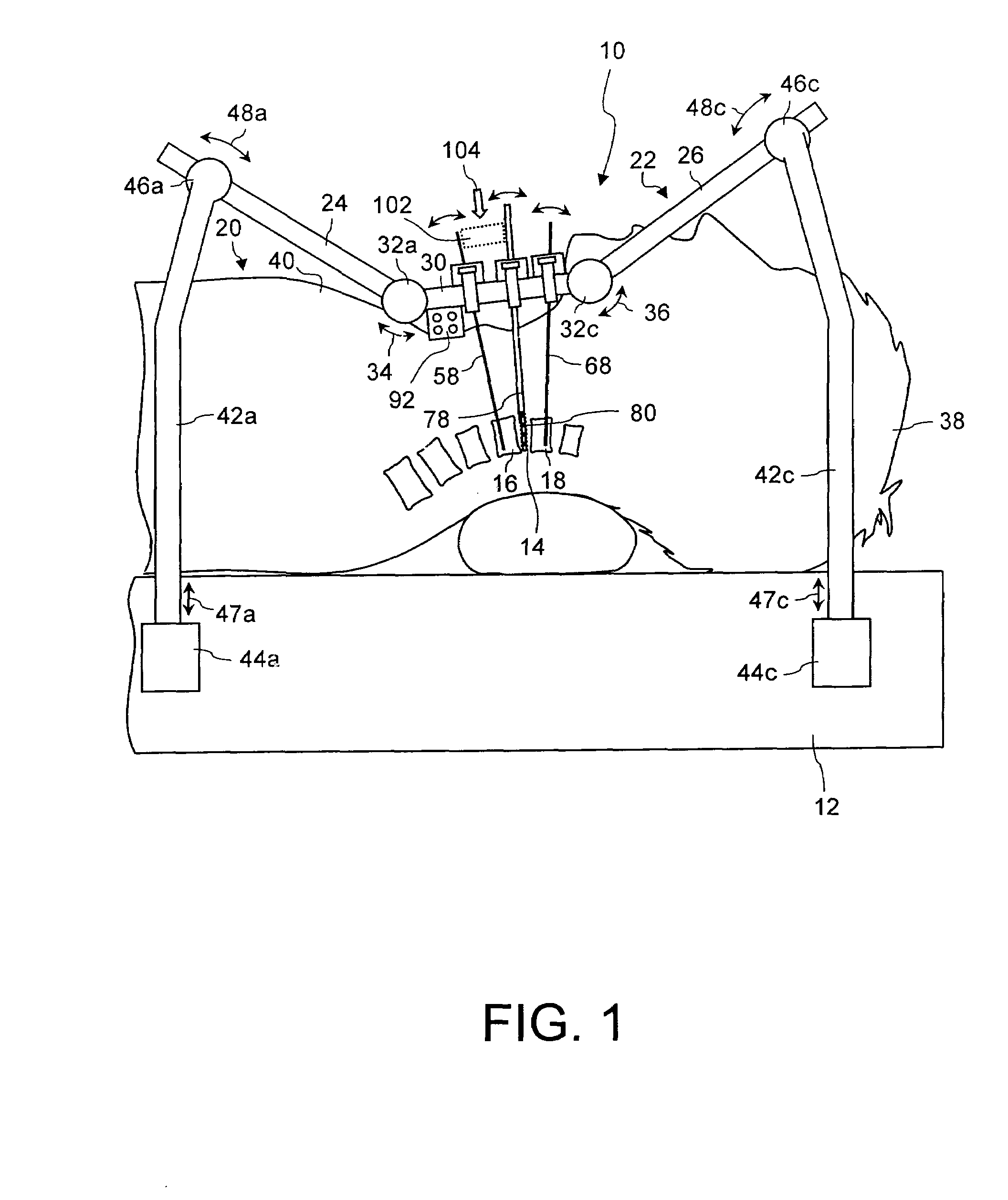 Preparation Device For Preparing an Intervertebral Disc Compartment