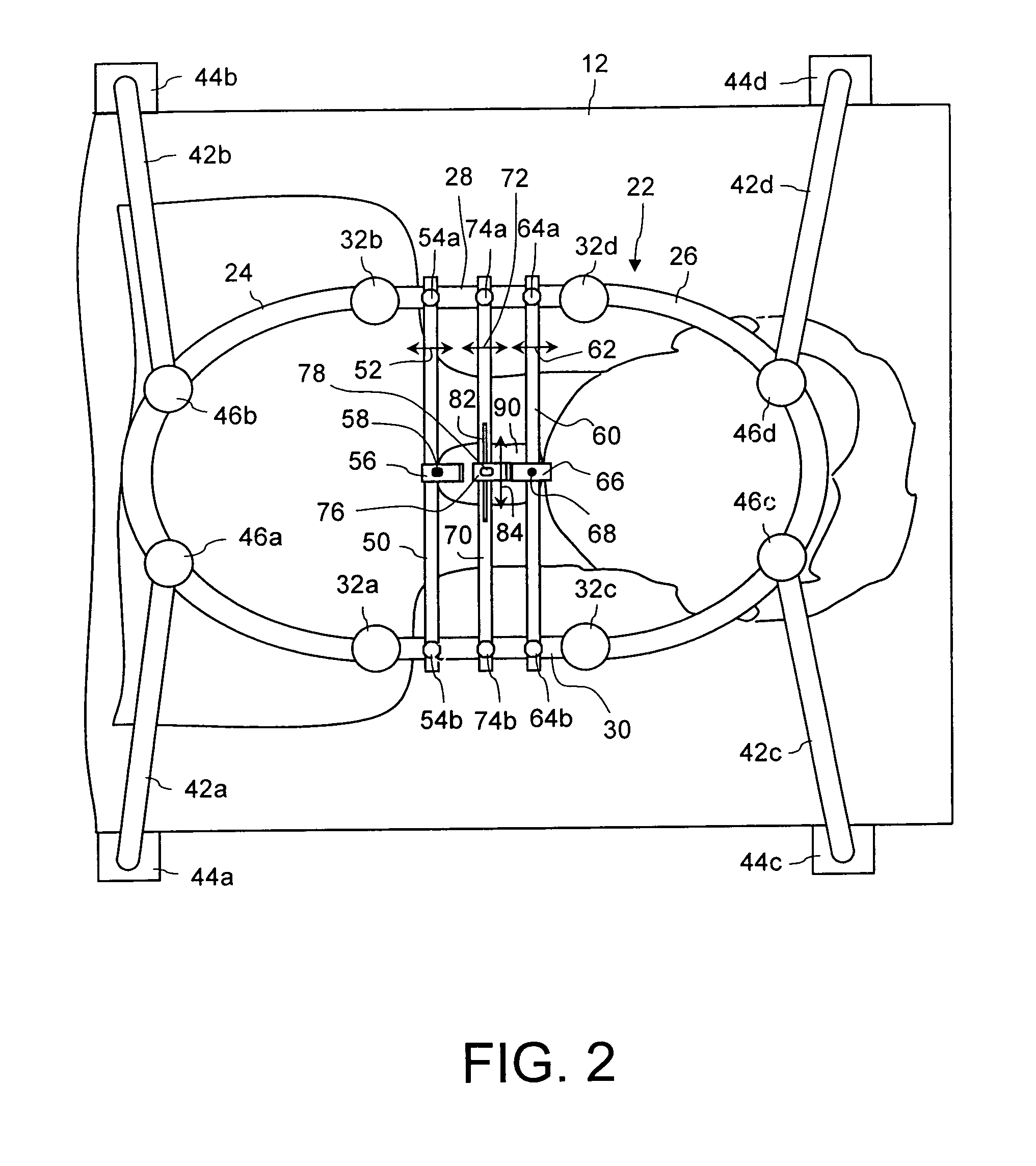 Preparation Device For Preparing an Intervertebral Disc Compartment