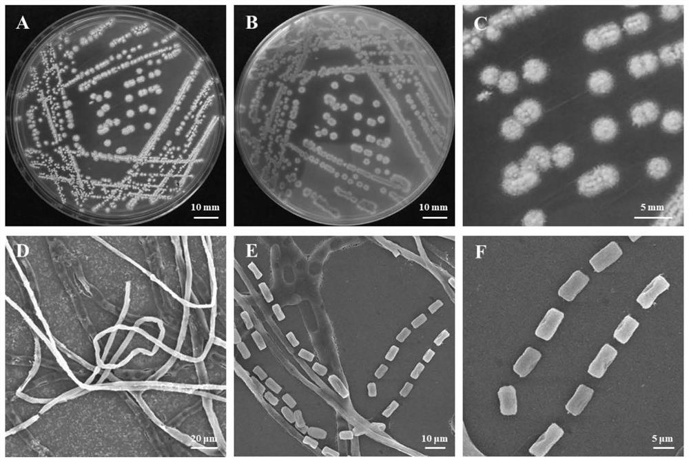 A kind of Streptomyces niger cys22, its metabolites and application