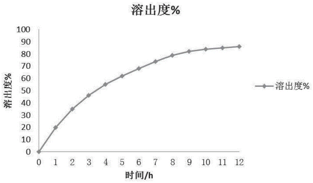 Sodium valproate oral preparation slow-release preparation and preparation method thereof