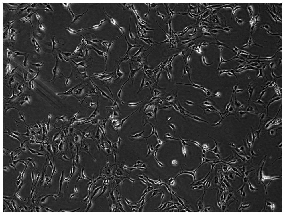 Method for preparing immortalized posterior longitudinal ligament cells of patient with posterior longitudinal ligament ossification