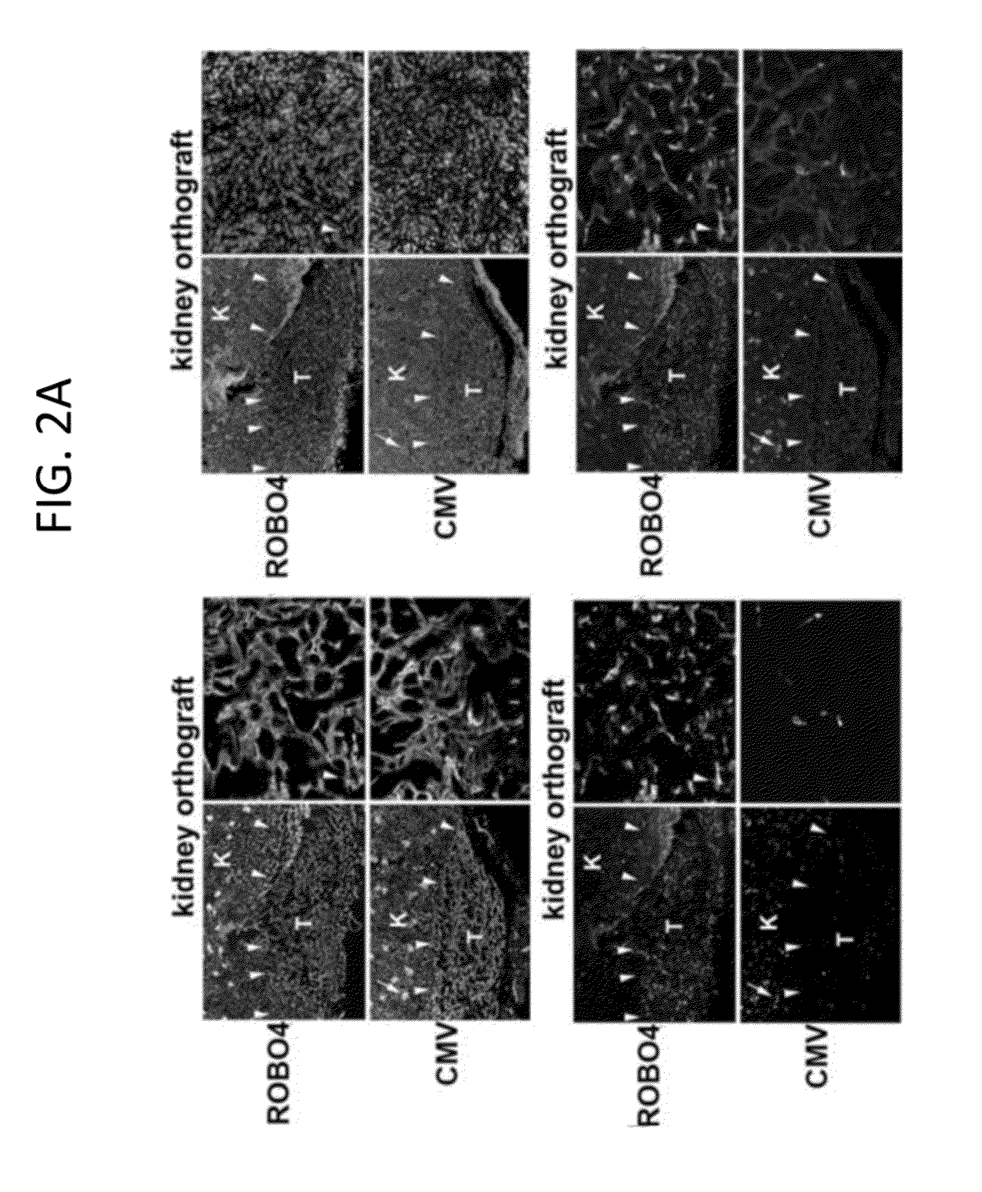 Endothelial-targeted Adenoviral Vectors, Methods and Uses Therefor