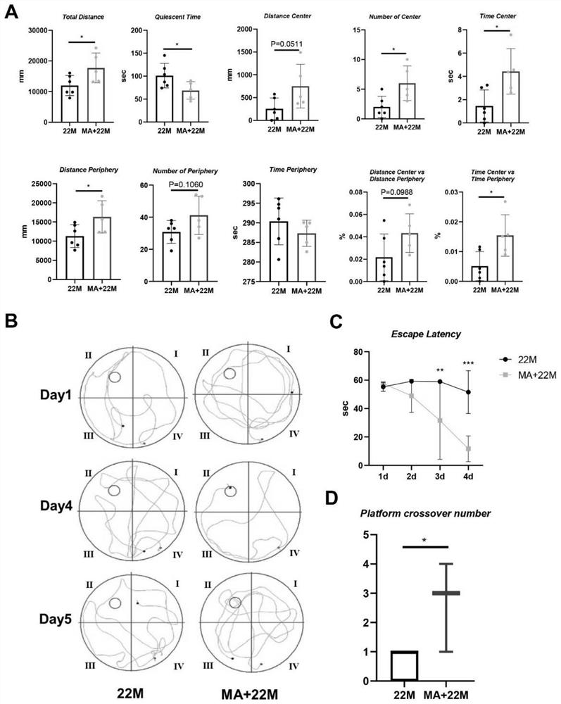 Application of myristic acid in preparation of brain aging resisting medicine