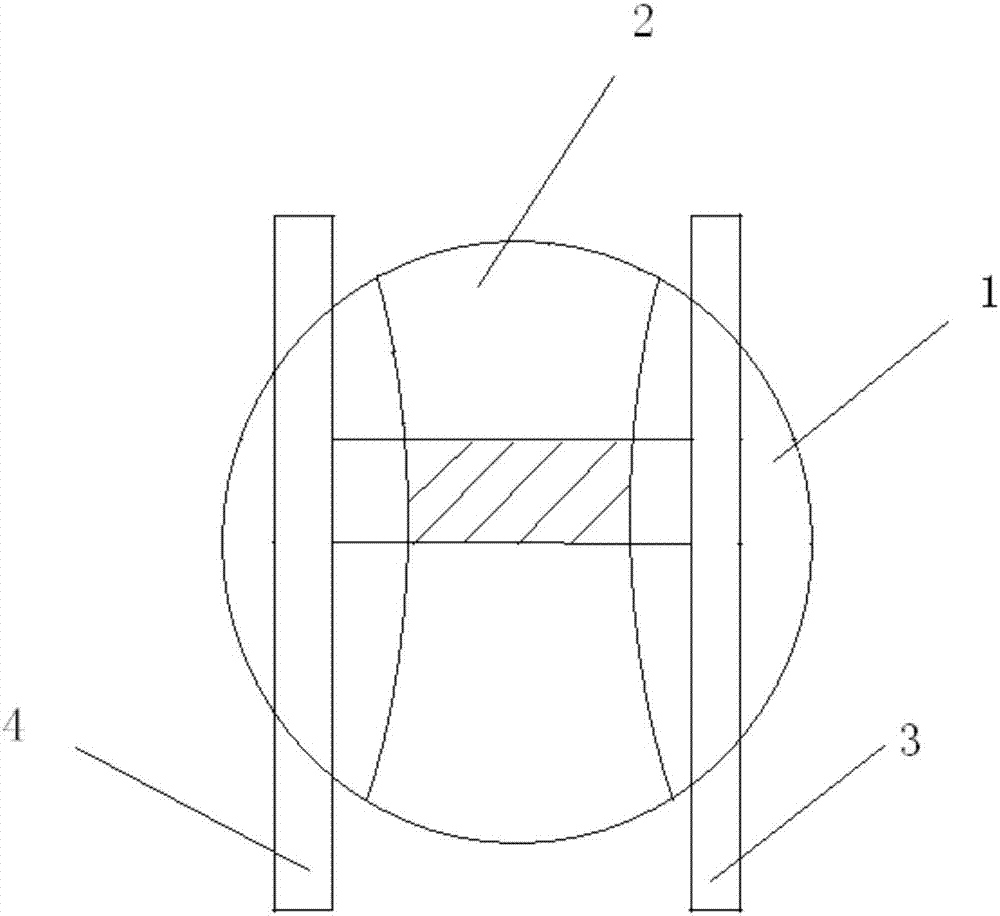 Detachable enterostomy stent and use method thereof