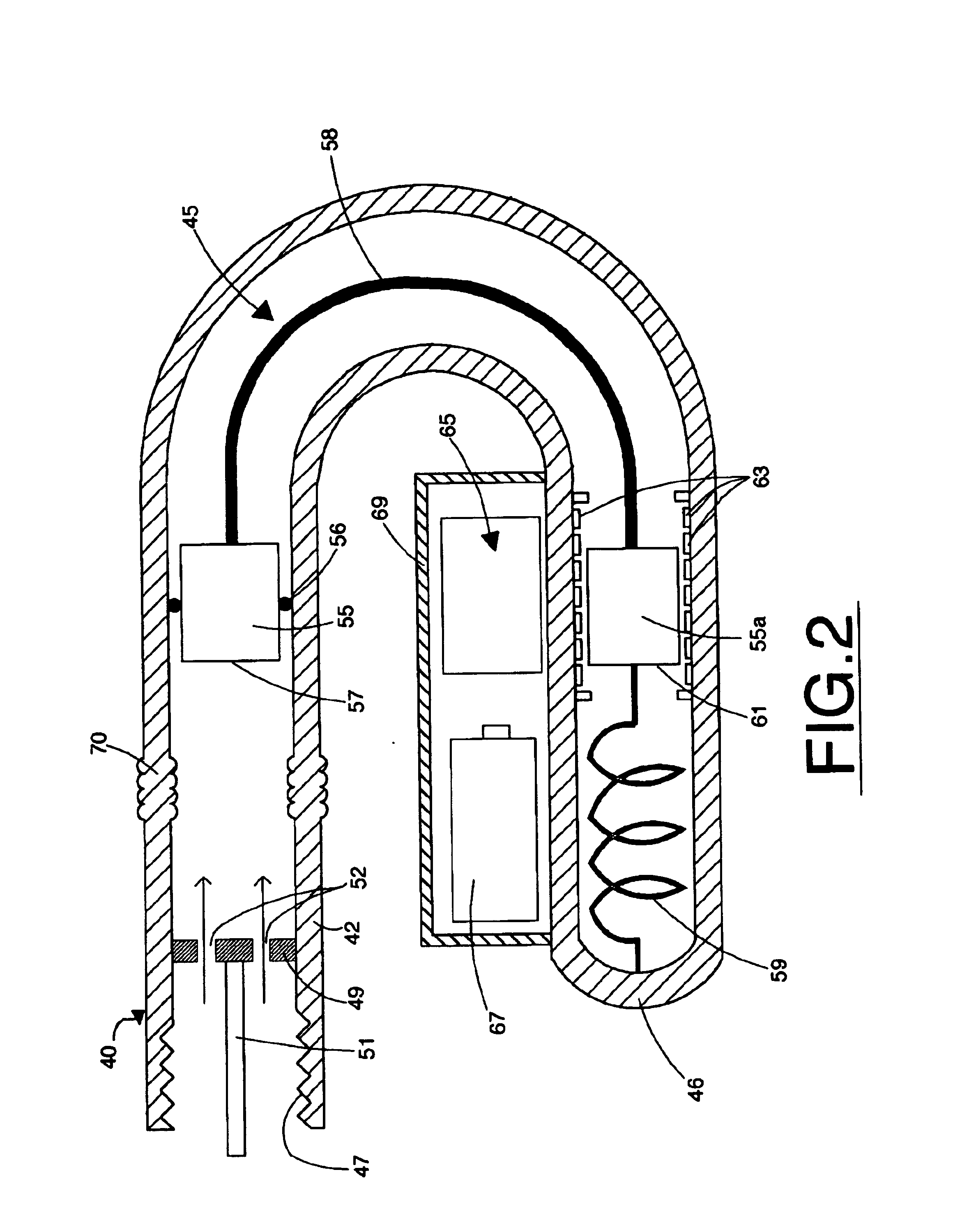 External mount differential tire pressure sensor system