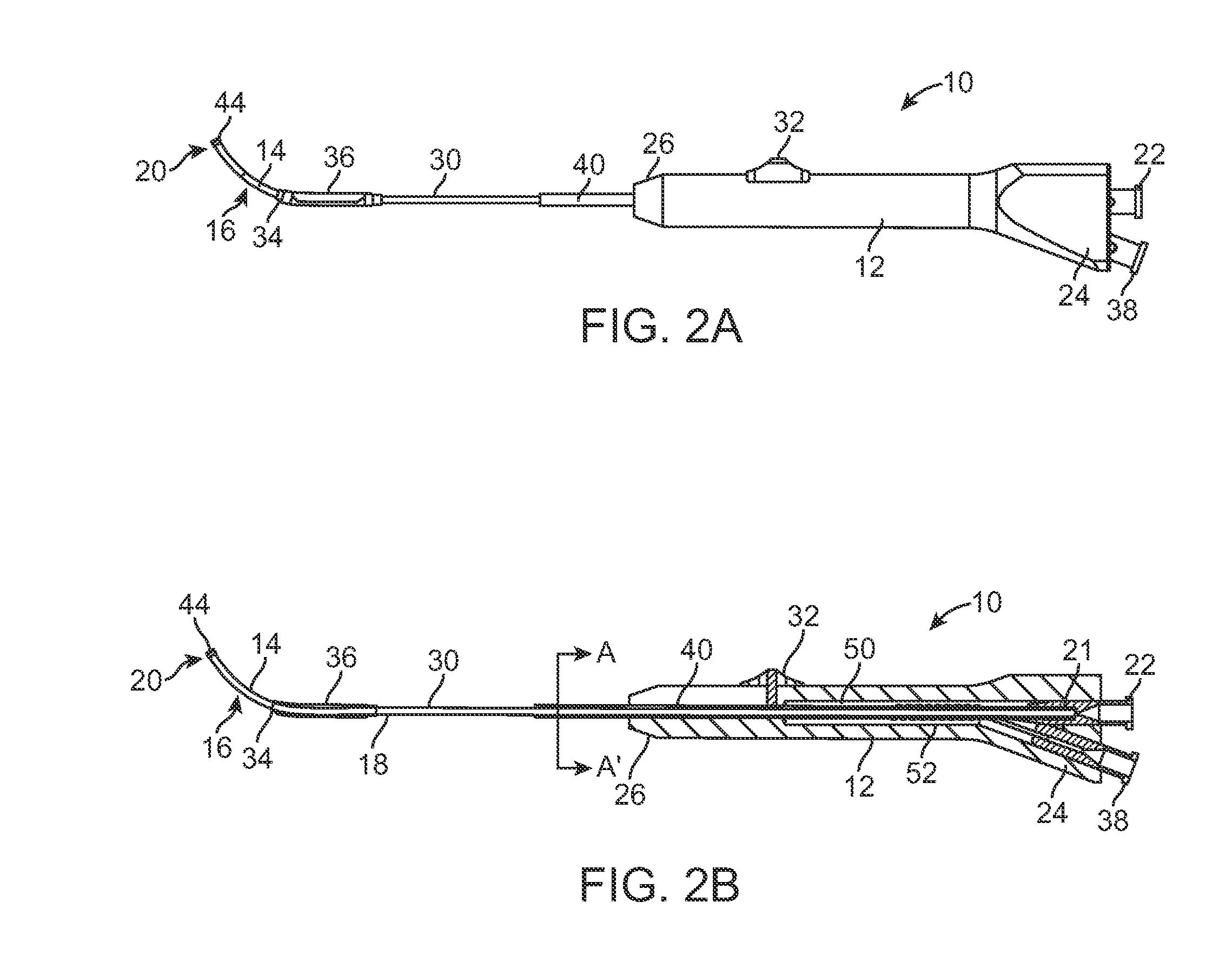 Frontal sinus dilation catheter