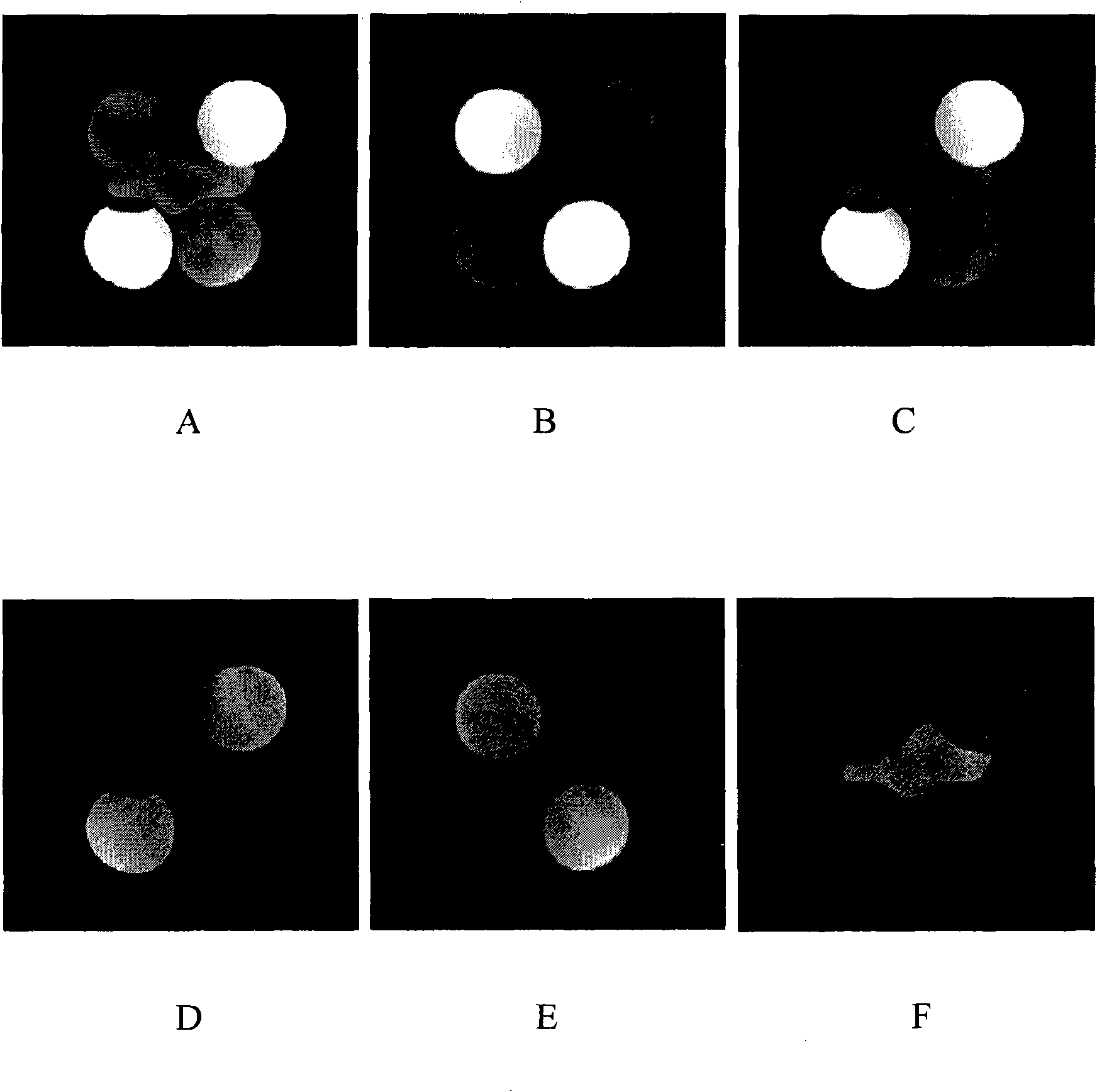 Tissue separation imaging method based on inversion recovery