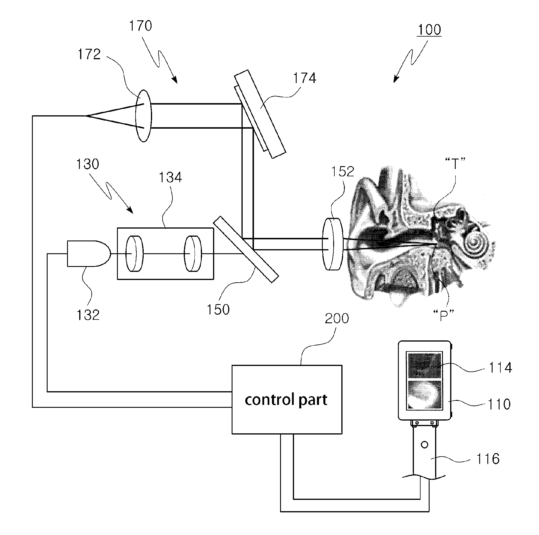 Optical tomographic imaging otoscope with integrated display and diagnosis