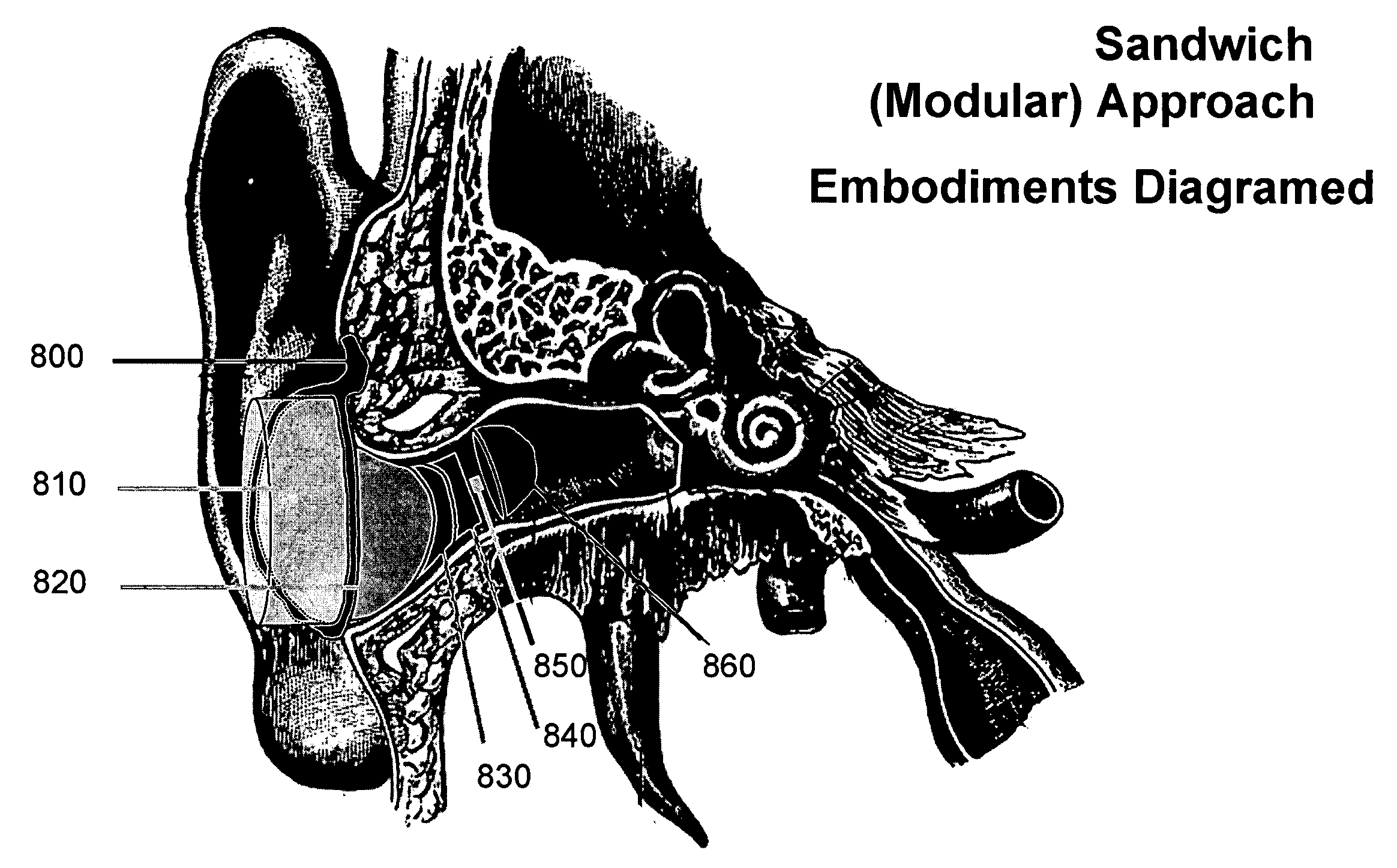 Earpiece Sealing System