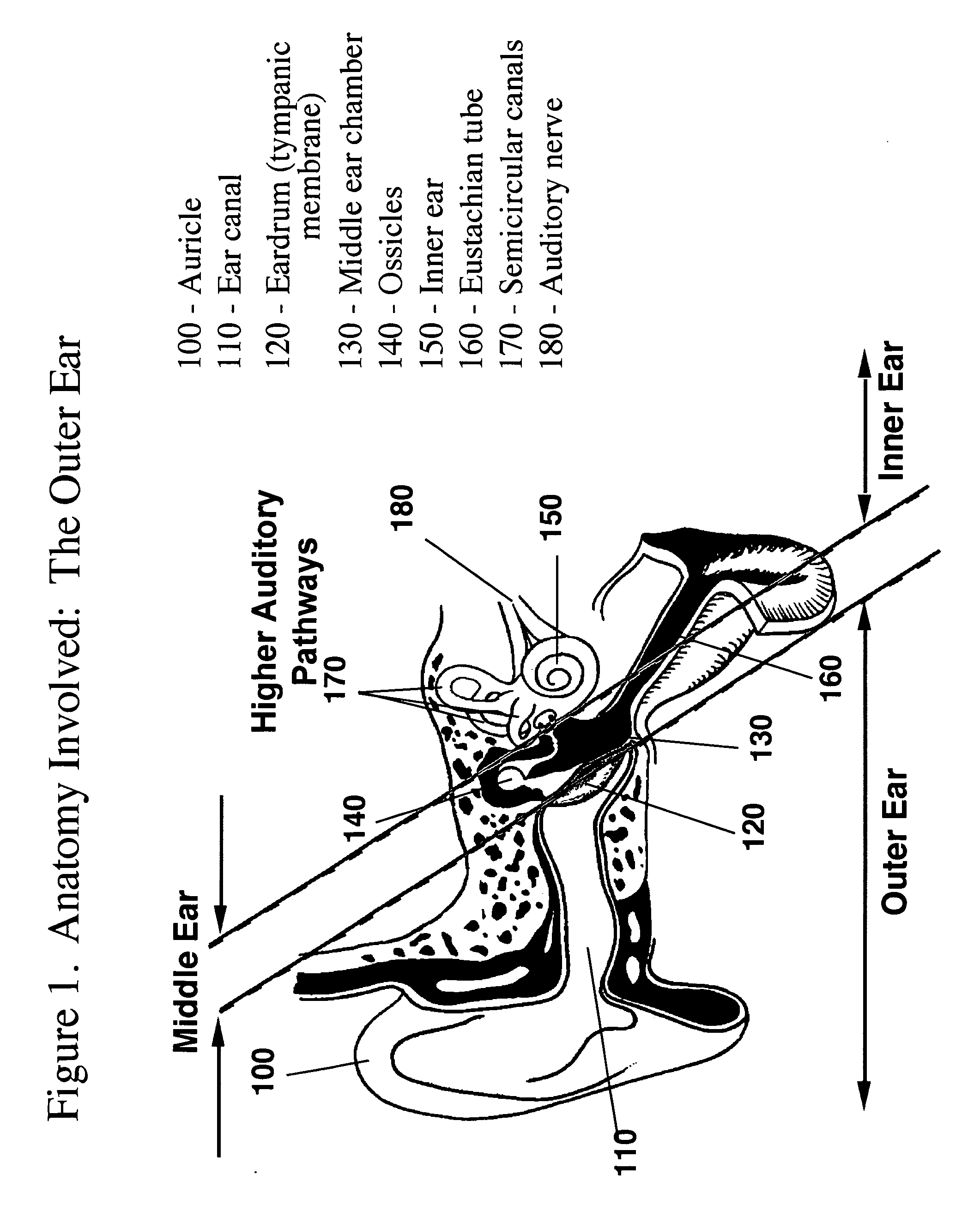 Earpiece Sealing System