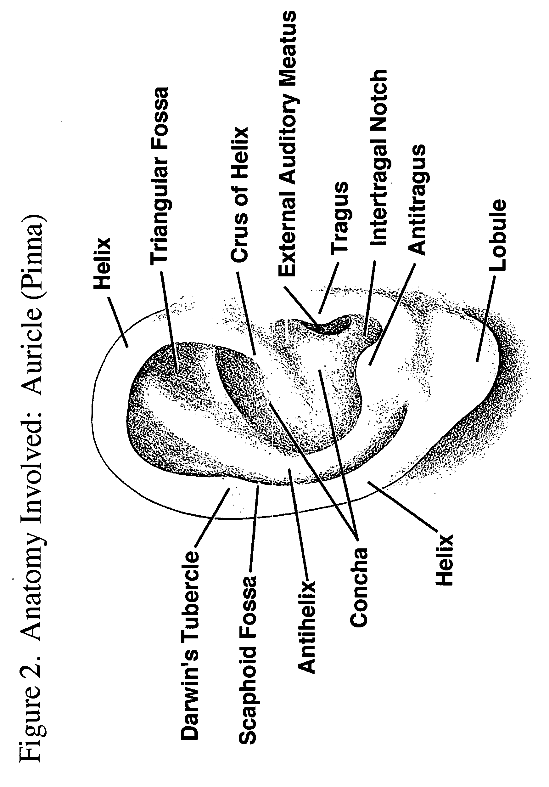 Earpiece Sealing System