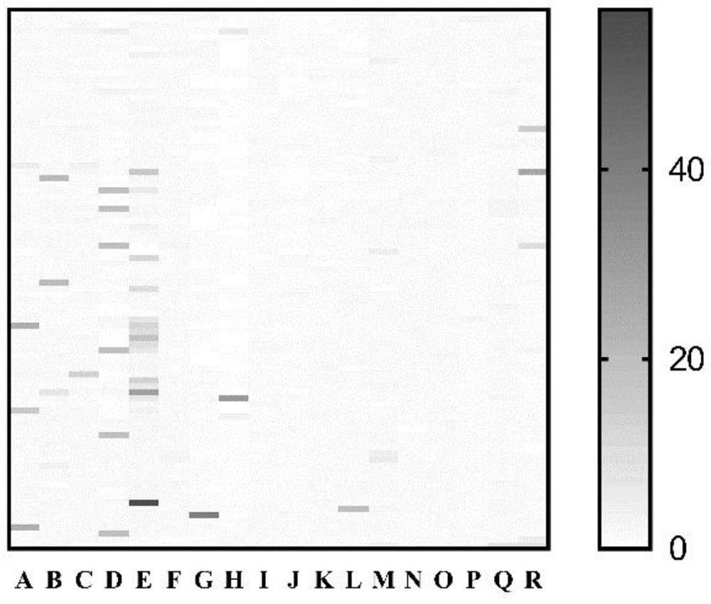 Application of UMI-77 as mitochondrial autophagy inducer to preparation of medicine for treating inflammation and neurodegenerative diseases