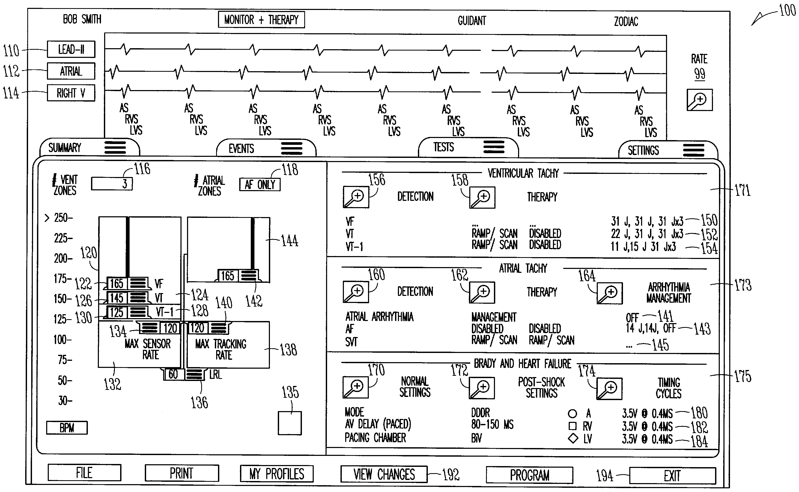 Medical device interface system with automatic rate threshold adjustment