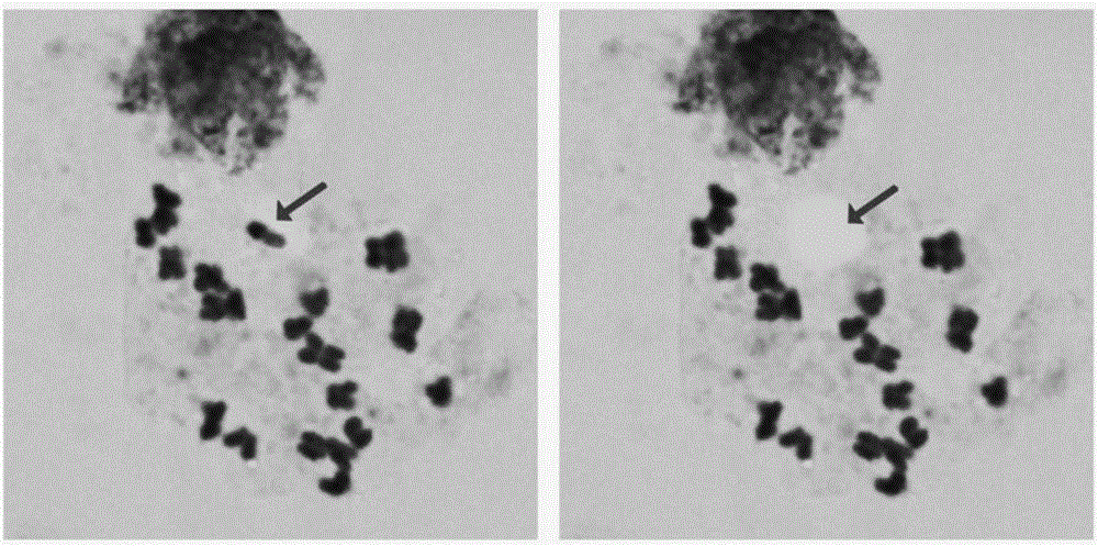 Microdissection technology of tobacco chromosomes