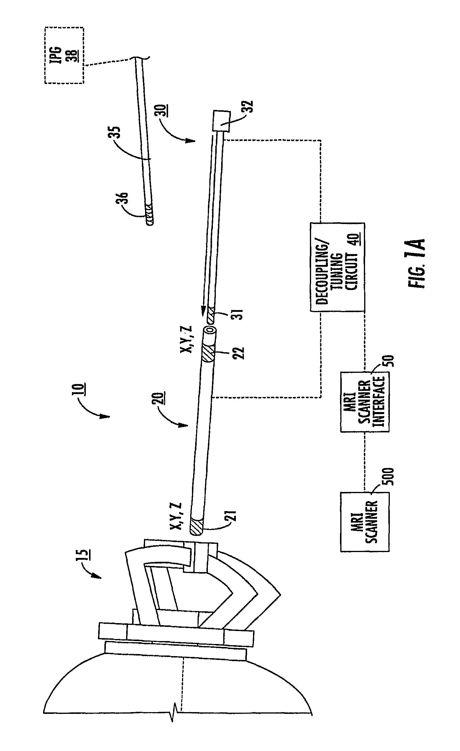 MRI-guided localization and/or lead placement systems, related methods, devices and computer program products