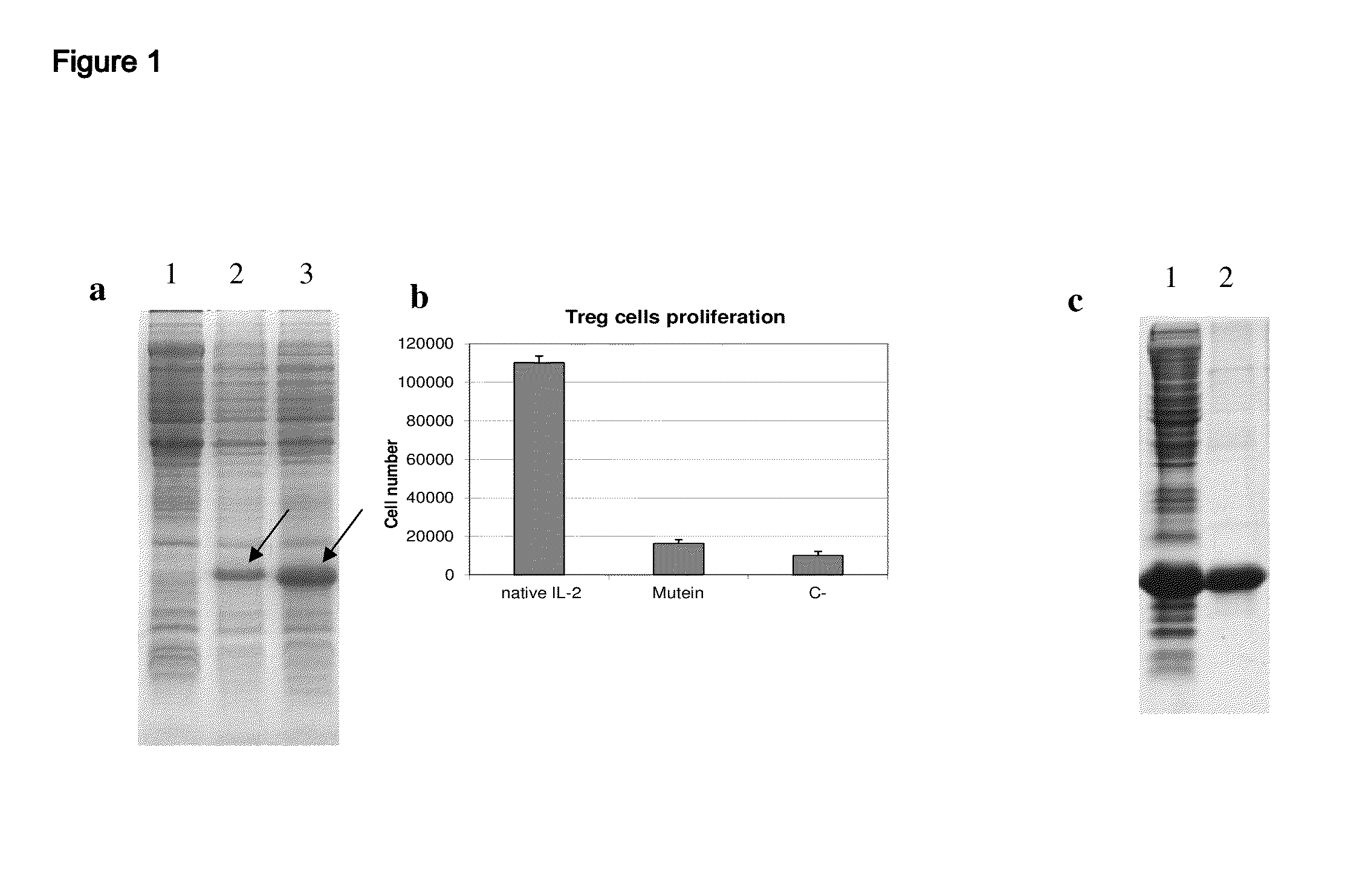 Il-2  derivatives polypeptides with agonist activity for therapy of cancer and chronic infections