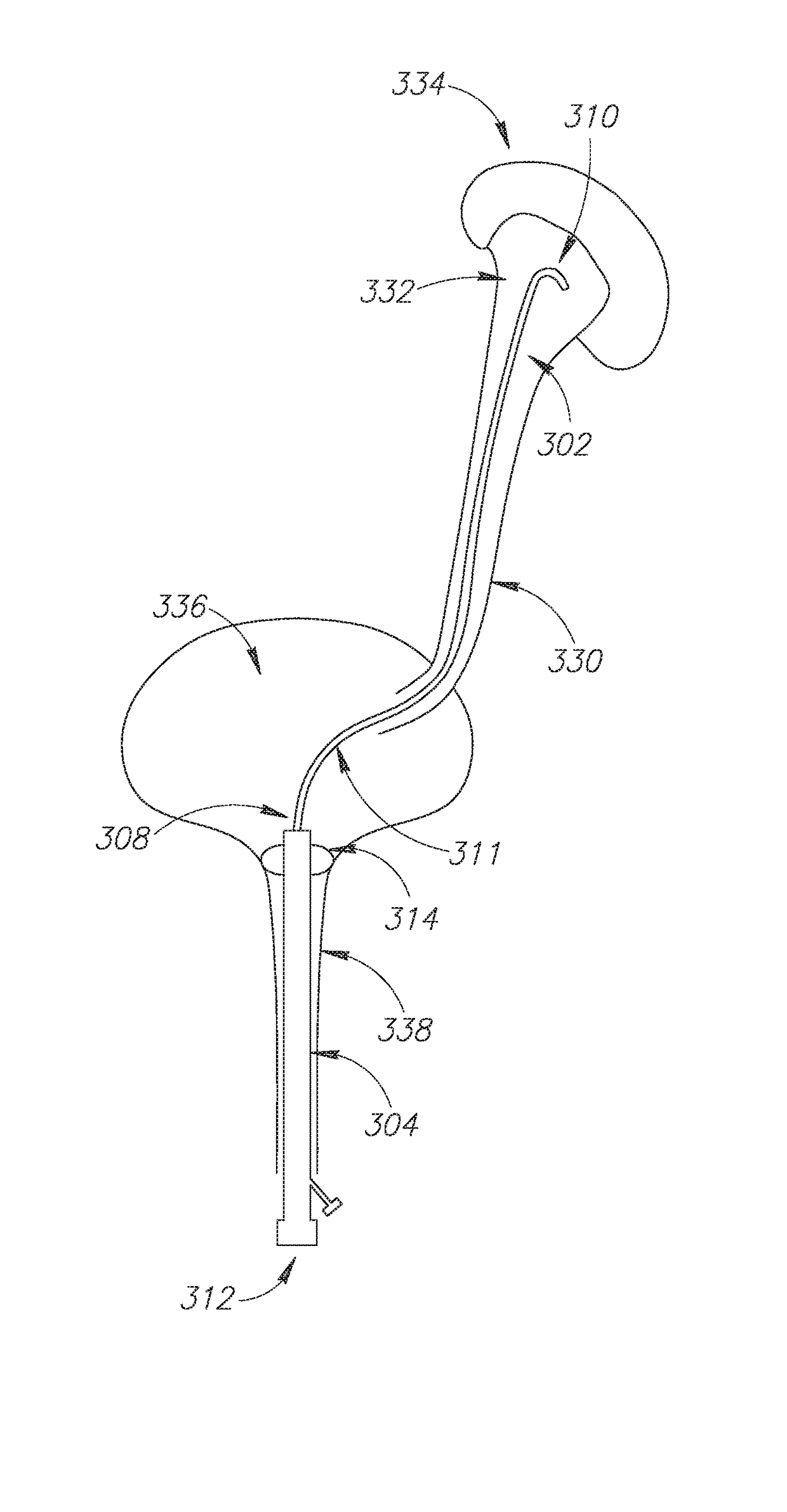 A connectable catheter