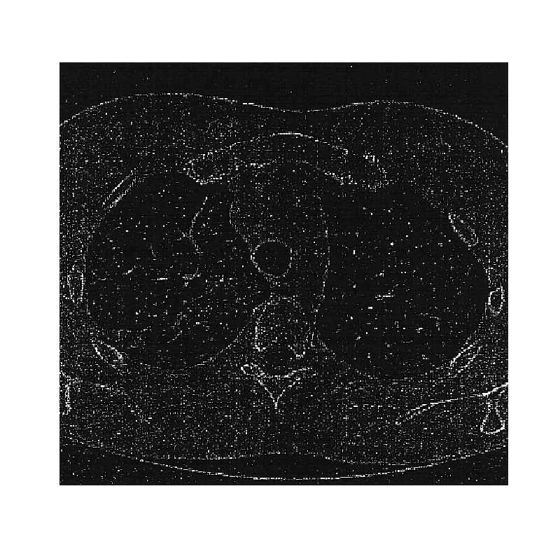 Detection and analysis of lesions in contact with a structural boundary