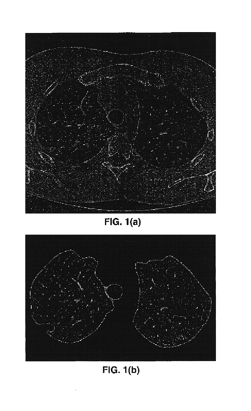 Detection and analysis of lesions in contact with a structural boundary