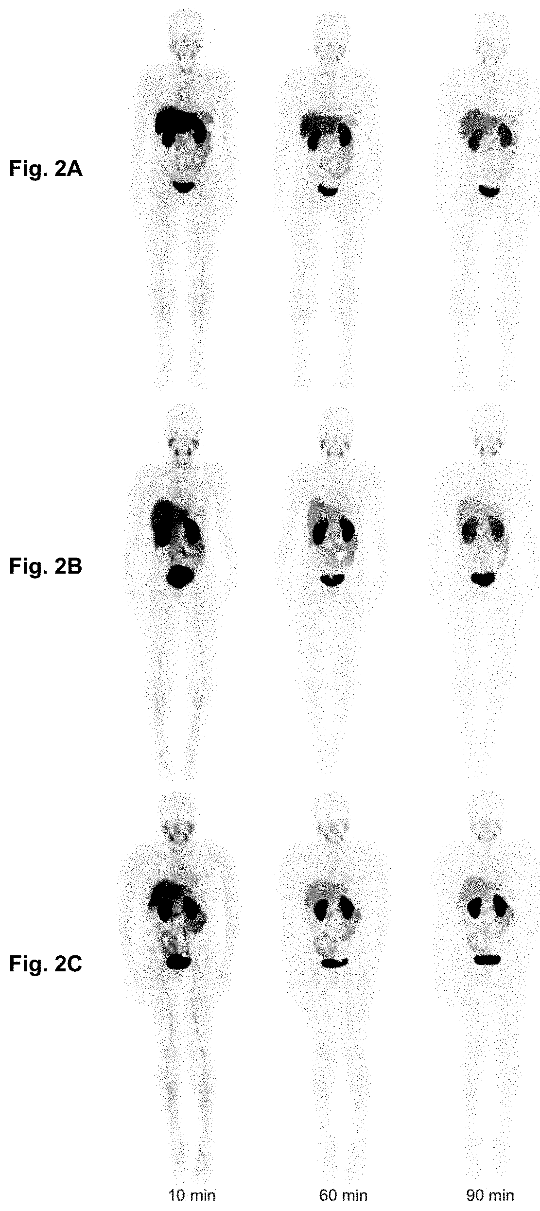 Radio-labelled antibody fragments for use in the prognosis, diagnosis of cancer as well as for the prediction of cancer therapy response