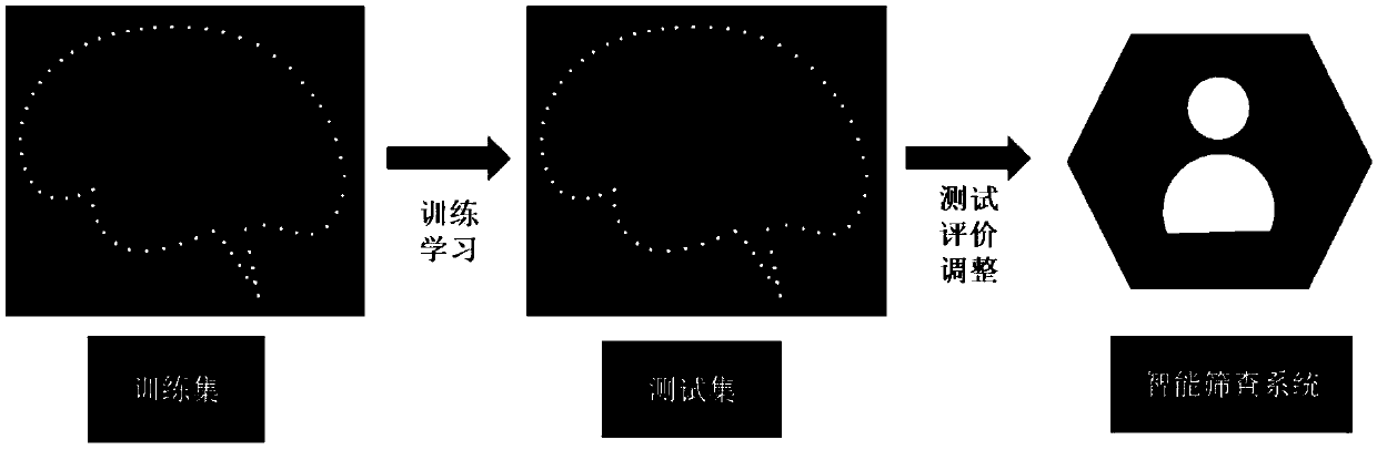 Intelligent screening system suitable for high myopia complicated by open angle glaucoma and establishment method thereof