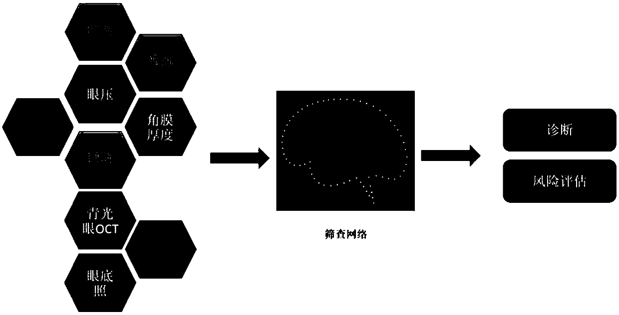 Intelligent screening system suitable for high myopia complicated by open angle glaucoma and establishment method thereof